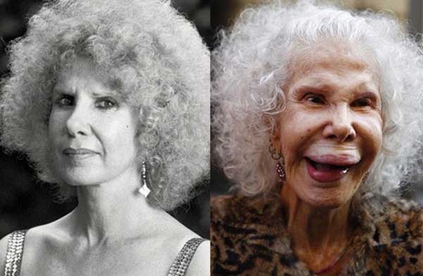 Cayetana Fitz before and after picture.